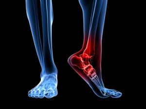 Potential Causes of Heel Pain