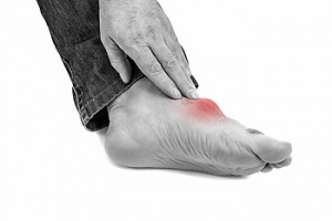 Gout 101